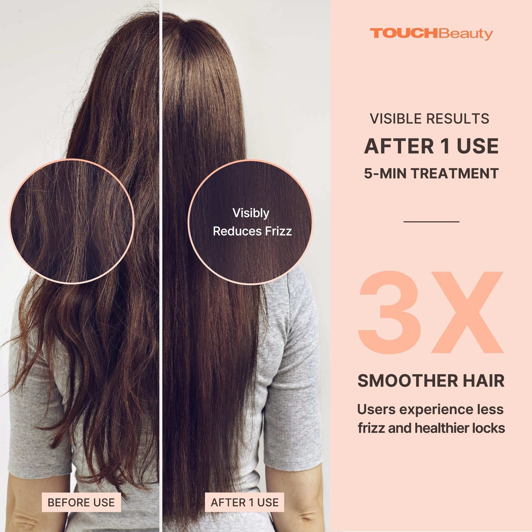 FTRHK-14031588-FEAT1-zoom