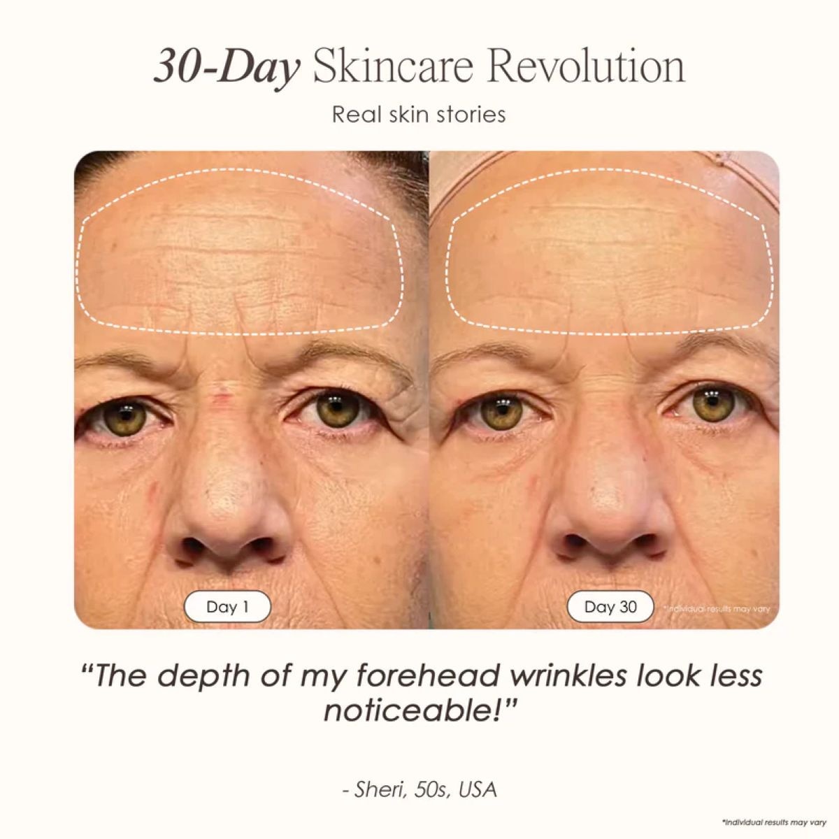 FTRHK-14090983-BACK-zoom